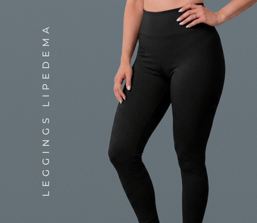 Lipedema